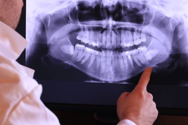 Best Broken or Cracked Tooth Emergency Dentist in Glendora, CA